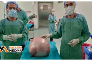 Karnından 35 kilogramlık kitle çıktı